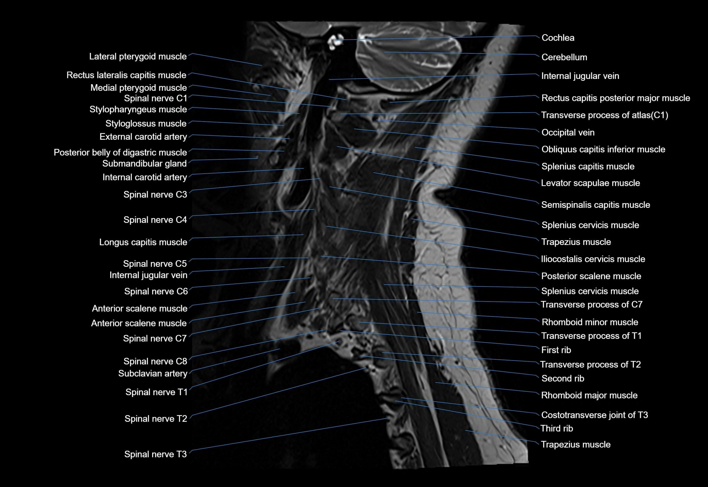 cervical spine cross sectional MRI anatomy 3T MRI  sagittal image-img-00001-00003.webp